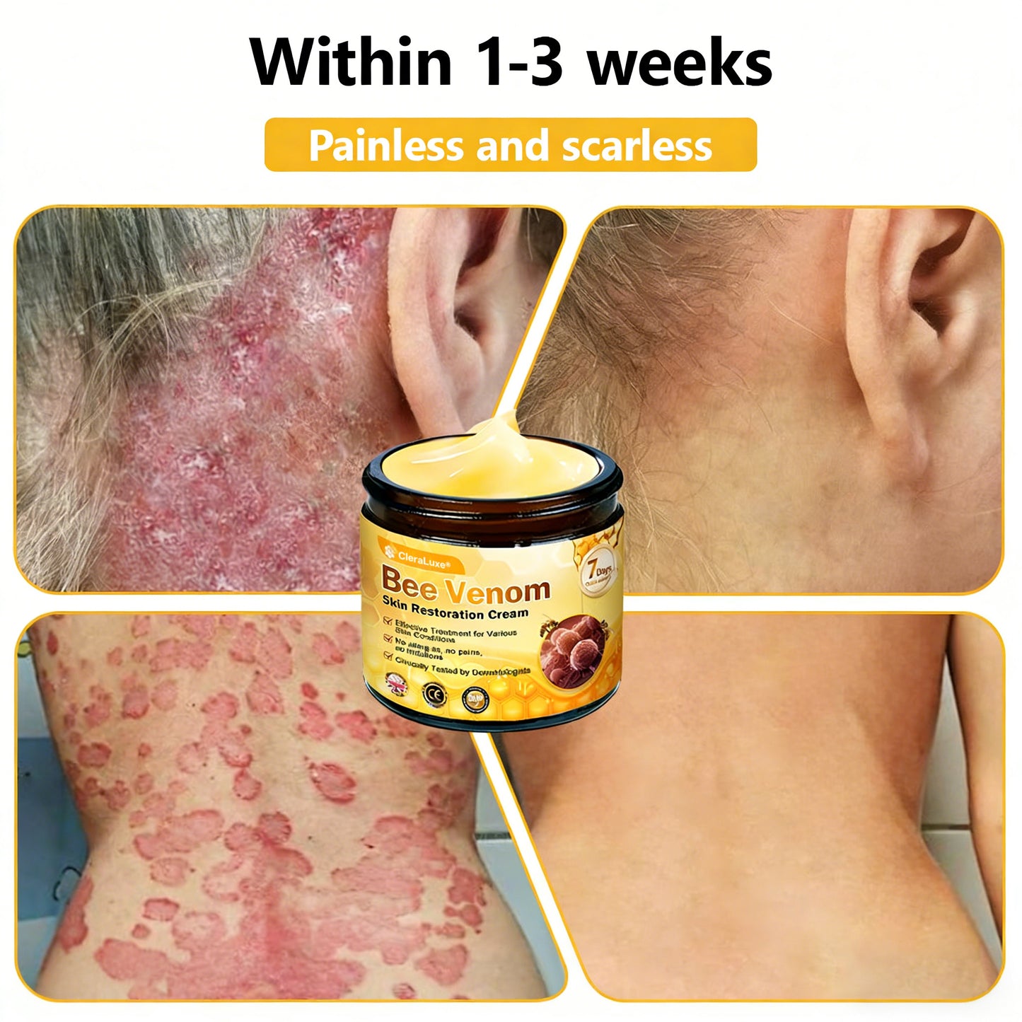 Made and Shipped from UK ✨ CleraLuxe® Bee Venom Skin Restoration Cream 🔥 LAST DAY 80% OFF📢
