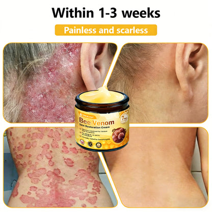 Made and Shipped from UK ✨ CleraLuxe® Bee Venom Skin Restoration Cream 🔥 LAST DAY 80% OFF📢