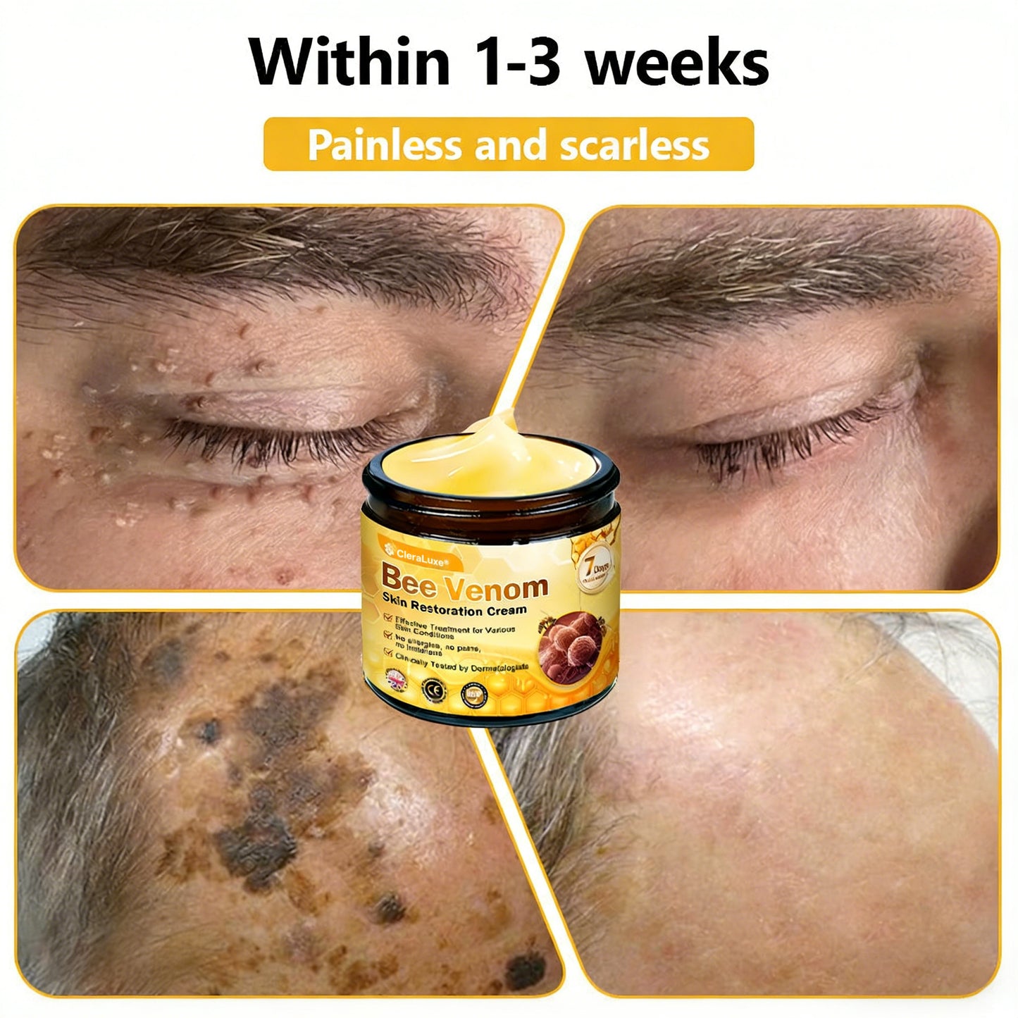 Made and Shipped from UK ✨ CleraLuxe® Bee Venom Skin Restoration Cream 🔥 LAST DAY 80% OFF📢