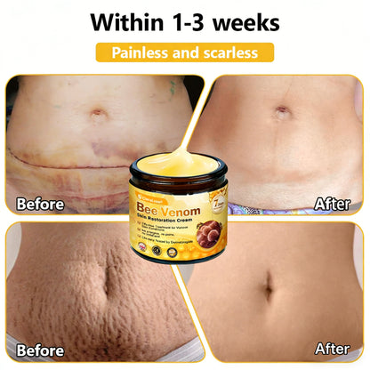 Made and Shipped from UK ✨ CleraLuxe® Bee Venom Skin Restoration Cream 🔥 LAST DAY 80% OFF📢