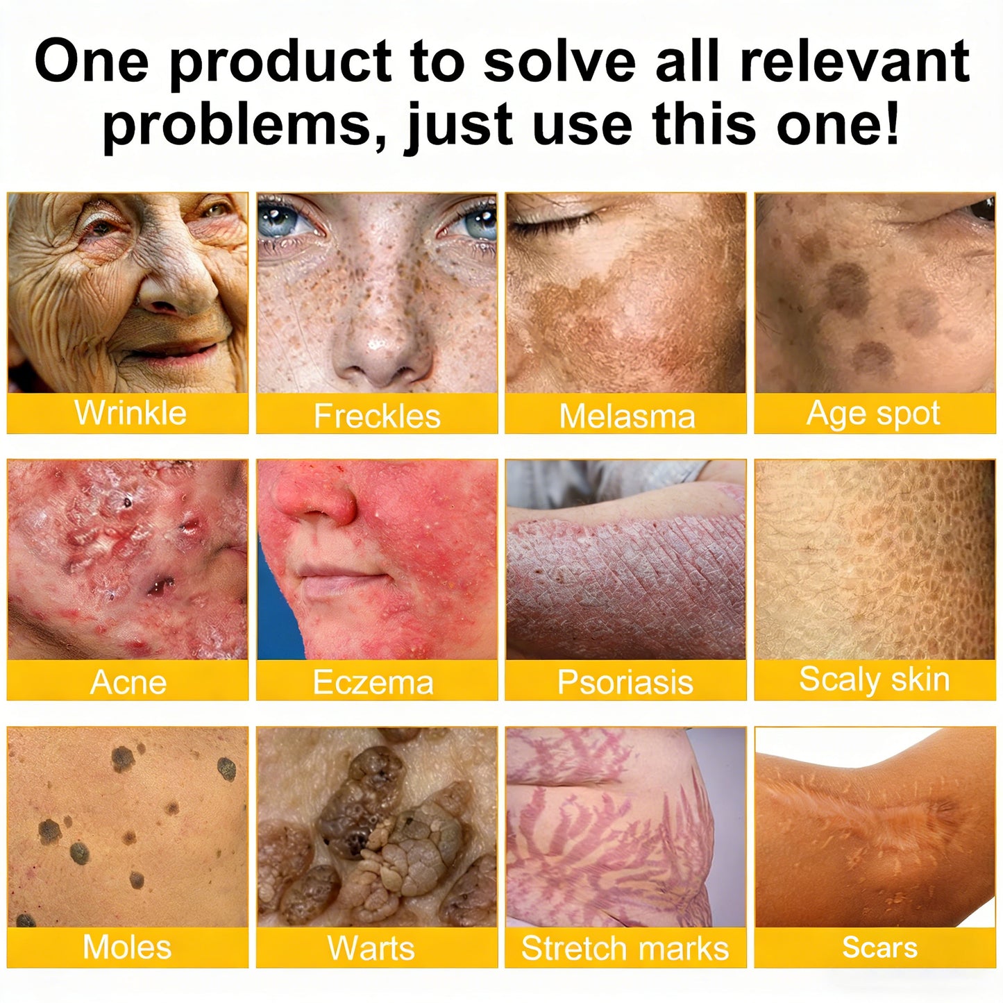 ⚡Fast-Acting bee Venom Wart Remover: CleraLuxe® Bee venom skin repair agent（✅️Results visible in 7 days.）