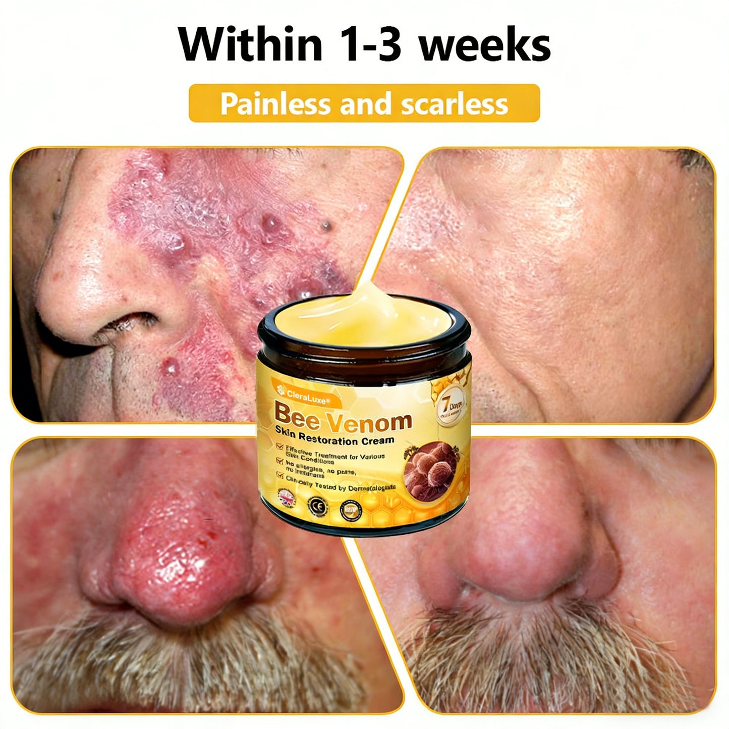 Made and Shipped from UK ✨ CleraLuxe® Bee Venom Skin Restoration Cream 🔥 LAST DAY 80% OFF📢