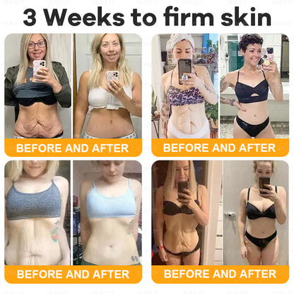 ⚡Fast-Acting bee Venom Wart Remover: CleraLuxe® Bee venom skin repair agent（✅️Results visible in 7 days.）