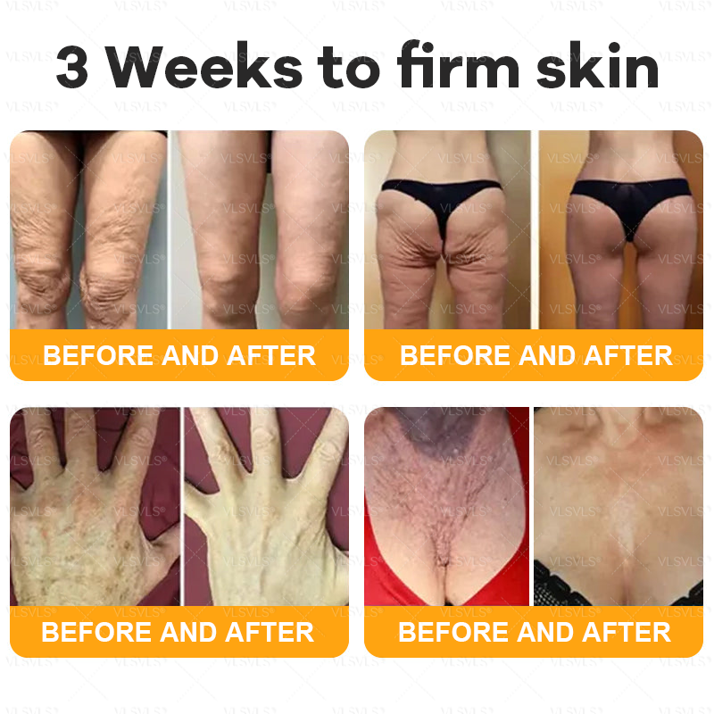 ⚡Fast-Acting bee Venom Wart Remover: CleraLuxe® Bee venom skin repair agent（✅️Results visible in 7 days.）