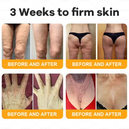 ⚡Fast-Acting bee Venom Wart Remover: CleraLuxe® Bee venom skin repair agent（✅️Results visible in 7 days.）