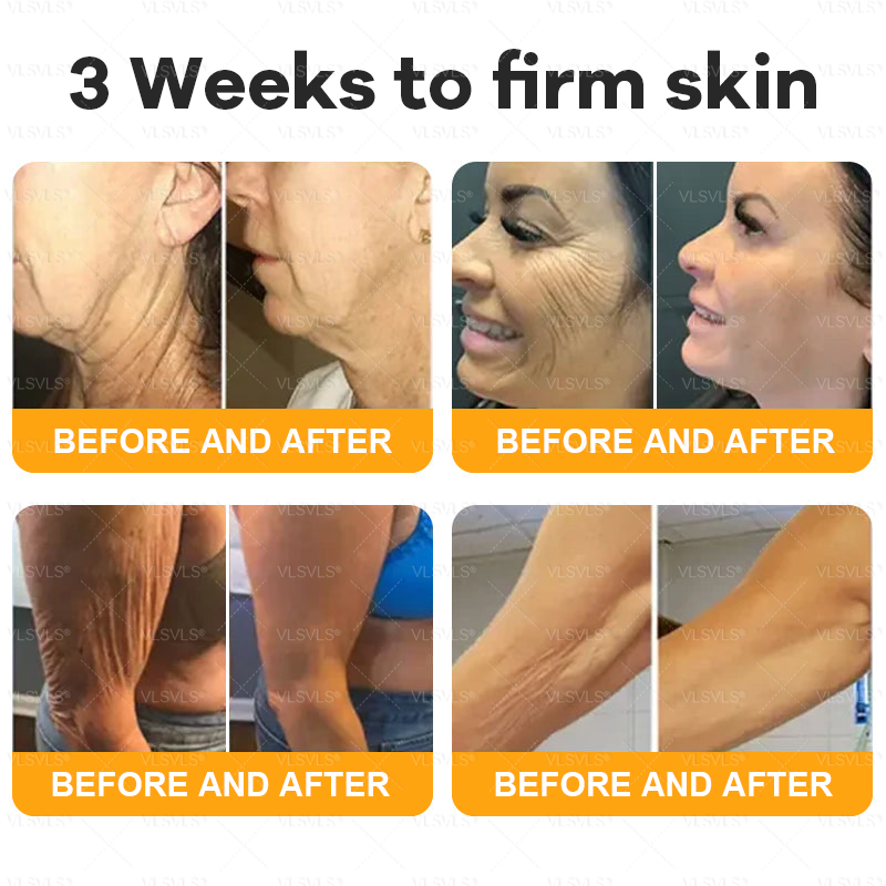 ⚡Fast-Acting bee Venom Wart Remover: CleraLuxe® Bee venom skin repair agent（✅️Results visible in 7 days.）