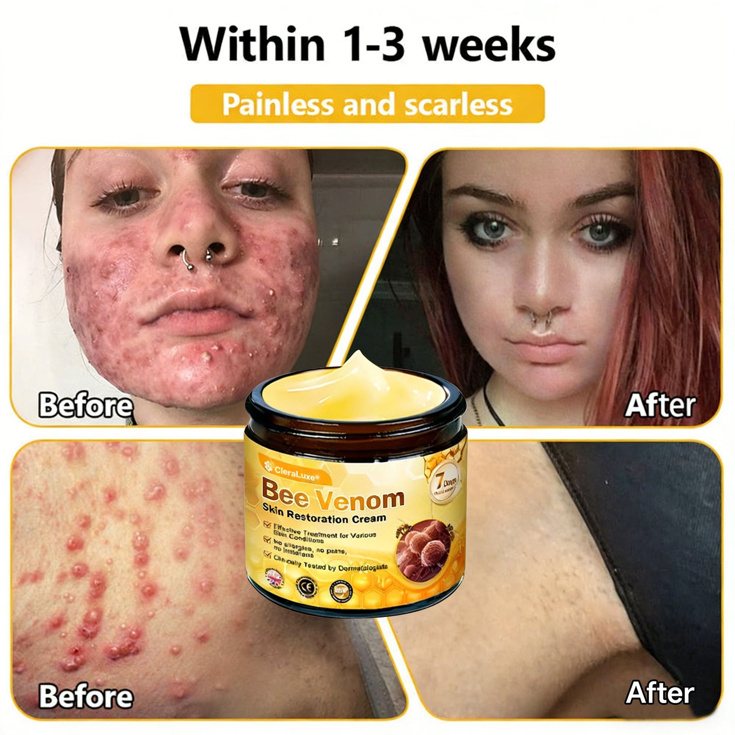 Made and Shipped from UK ✨ CleraLuxe® Bee Venom Skin Restoration Cream 🔥 LAST DAY 80% OFF📢