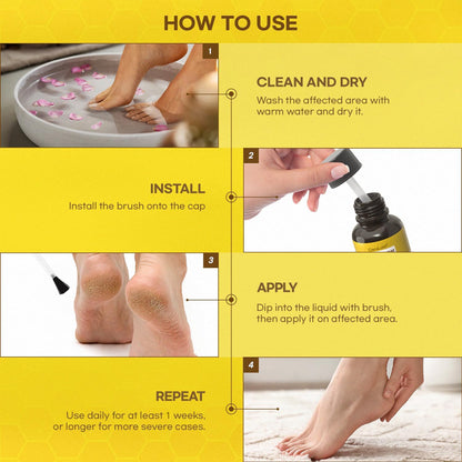 ⚡Fast-Acting bee Venom Wart Remover: CleraLuxe® Bee venom skin repair agent（✅️Results visible in 7 days.）