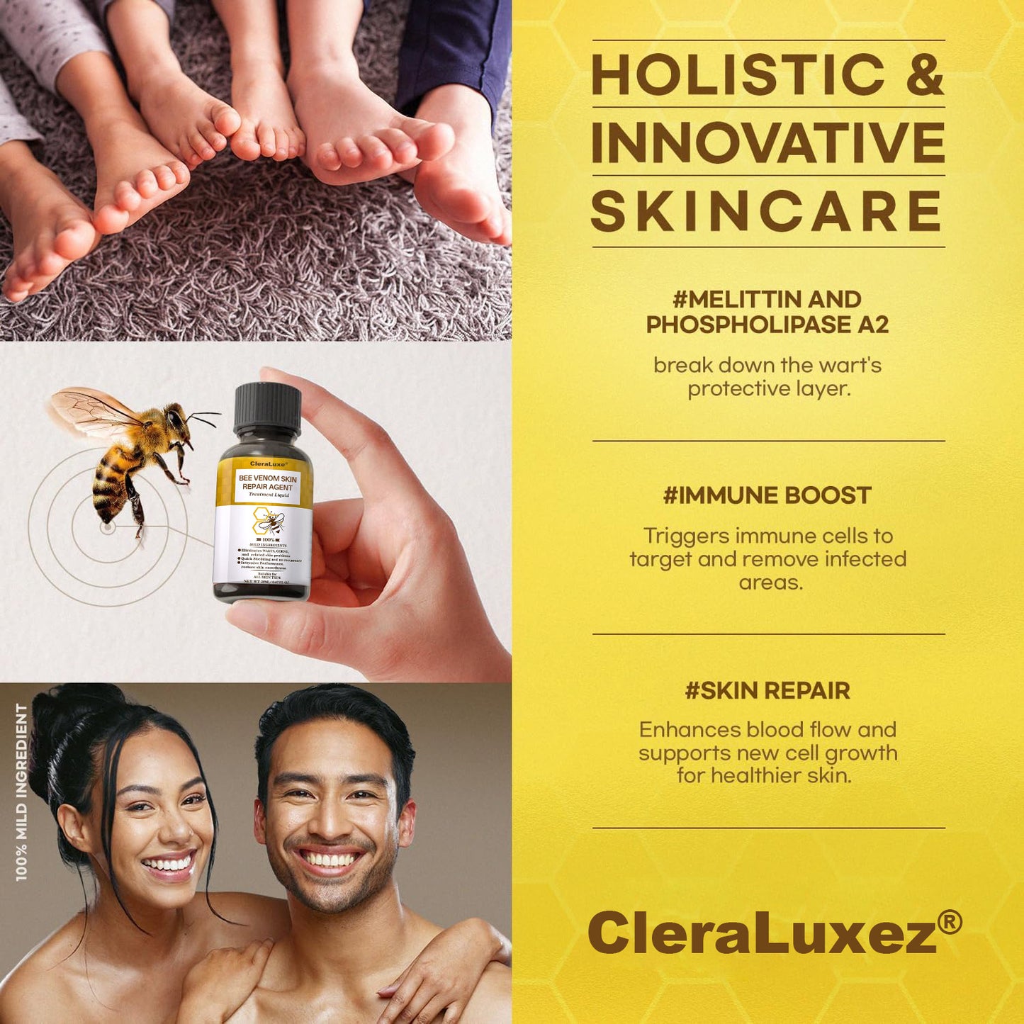⚡Fast-Acting bee Venom Wart Remover: CleraLuxe® Bee venom skin repair agent（✅️Results visible in 7 days.）
