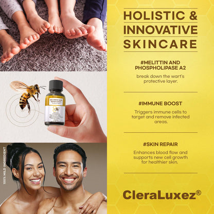 ⚡Fast-Acting bee Venom Wart Remover: CleraLuxe® Bee venom skin repair agent（✅️Results visible in 7 days.）